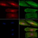 SETDB2 Antibody in Immunocytochemistry (ICC/IF)