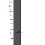 KappaB ras2 Antibody in Western Blot (WB)