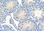 ALKBH5 Antibody in Immunohistochemistry (Paraffin) (IHC (P))