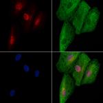 E2F8 Antibody in Immunocytochemistry (ICC/IF)