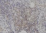 E2F8 Antibody in Immunohistochemistry (Paraffin) (IHC (P))