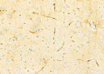 ZDHHC13 Antibody in Immunohistochemistry (Paraffin) (IHC (P))