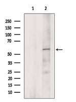 ZDHHC13 Antibody in Western Blot (WB)