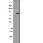 ZBTB16 Antibody in Western Blot (WB)