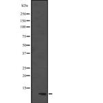 DYNLL1 Antibody in Western Blot (WB)