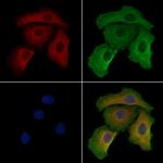 MAGEB5 Antibody in Immunocytochemistry (ICC/IF)