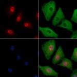 TSSK3 Antibody in Immunocytochemistry (ICC/IF)