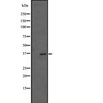 TRIB2 Antibody in Western Blot (WB)