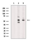 HTR3A Antibody in Western Blot (WB)