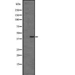 CMKLR1 Antibody in Western Blot (WB)