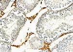 GPR21 Antibody in Immunohistochemistry (Paraffin) (IHC (P))