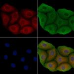 LPAR5 Antibody in Immunocytochemistry (ICC/IF)