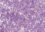 CXCR2 Antibody in Immunohistochemistry (Paraffin) (IHC (P))