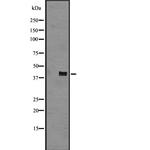 CXCR2 Antibody in Western Blot (WB)