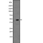 NMUR2 Antibody in Western Blot (WB)