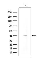 NPY4R Antibody in Western Blot (WB)