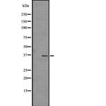 OR4C45 Antibody in Western Blot (WB)