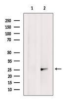 OR2M4 Antibody in Western Blot (WB)