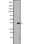 OR2V2 Antibody in Western Blot (WB)