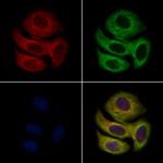 Enkurin Antibody in Immunocytochemistry (ICC/IF)