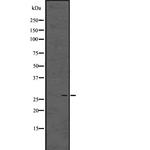 Enkurin Antibody in Western Blot (WB)