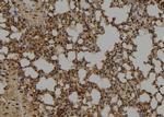 ID1 Antibody in Immunohistochemistry (Paraffin) (IHC (P))