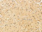 LRP1 Antibody in Immunohistochemistry (Paraffin) (IHC (P))