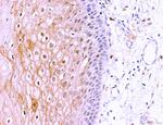 LRP1 Antibody in Immunohistochemistry (Paraffin) (IHC (P))