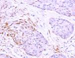 LRP1 Antibody in Immunohistochemistry (Paraffin) (IHC (P))