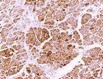 LRP1 Antibody in Immunohistochemistry (Paraffin) (IHC (P))