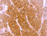 LRP1 Antibody in Immunohistochemistry (Paraffin) (IHC (P))