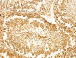 LRP1 Antibody in Immunohistochemistry (Paraffin) (IHC (P))