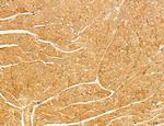 LRP1 Antibody in Immunohistochemistry (Paraffin) (IHC (P))