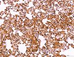 LRP1 Antibody in Immunohistochemistry (Paraffin) (IHC (P))