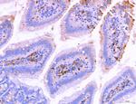 LRP1 Antibody in Immunohistochemistry (Paraffin) (IHC (P))