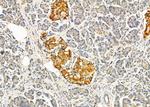 PMEL Antibody in Immunohistochemistry (Paraffin) (IHC (P))