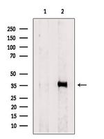 PP1 alpha/beta Antibody in Western Blot (WB)