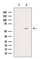 PTBP2 Antibody in Western Blot (WB)