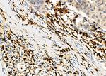 RAB9 Antibody in Immunohistochemistry (Paraffin) (IHC (P))