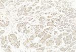 Phospho-DNM1L (Ser637) Antibody in Immunohistochemistry (Paraffin) (IHC (P))