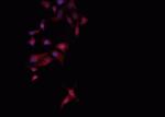 Phospho-DNM1L (Ser637) Antibody in Immunocytochemistry (ICC/IF)