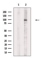 Phospho-Catenin alpha-1 (Ser655, Thr658) Antibody in Western Blot (WB)