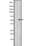 KLF11 Antibody in Western Blot (WB)