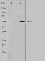 AKAP8 Antibody in Western Blot (WB)