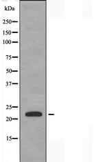 MSC Antibody in Western Blot (WB)