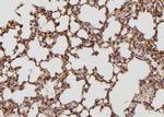 BCAR3 Antibody in Immunohistochemistry (Paraffin) (IHC (P))