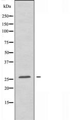 LRAT Antibody in Western Blot (WB)