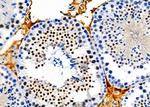 TOP3B Antibody in Immunohistochemistry (Paraffin) (IHC (P))