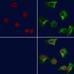 ATF3 Antibody in Immunocytochemistry (ICC/IF)