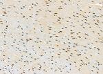 PRKAR1B Antibody in Immunohistochemistry (Paraffin) (IHC (P))